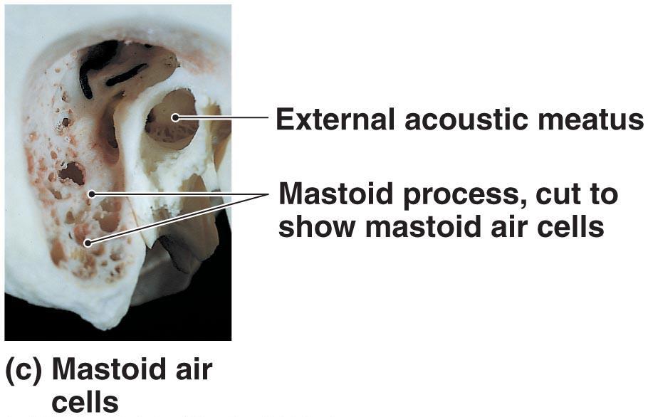 Marks of Temporal Bones Mastoid process: For muscle attachment Contains mastoid air cells connected to
