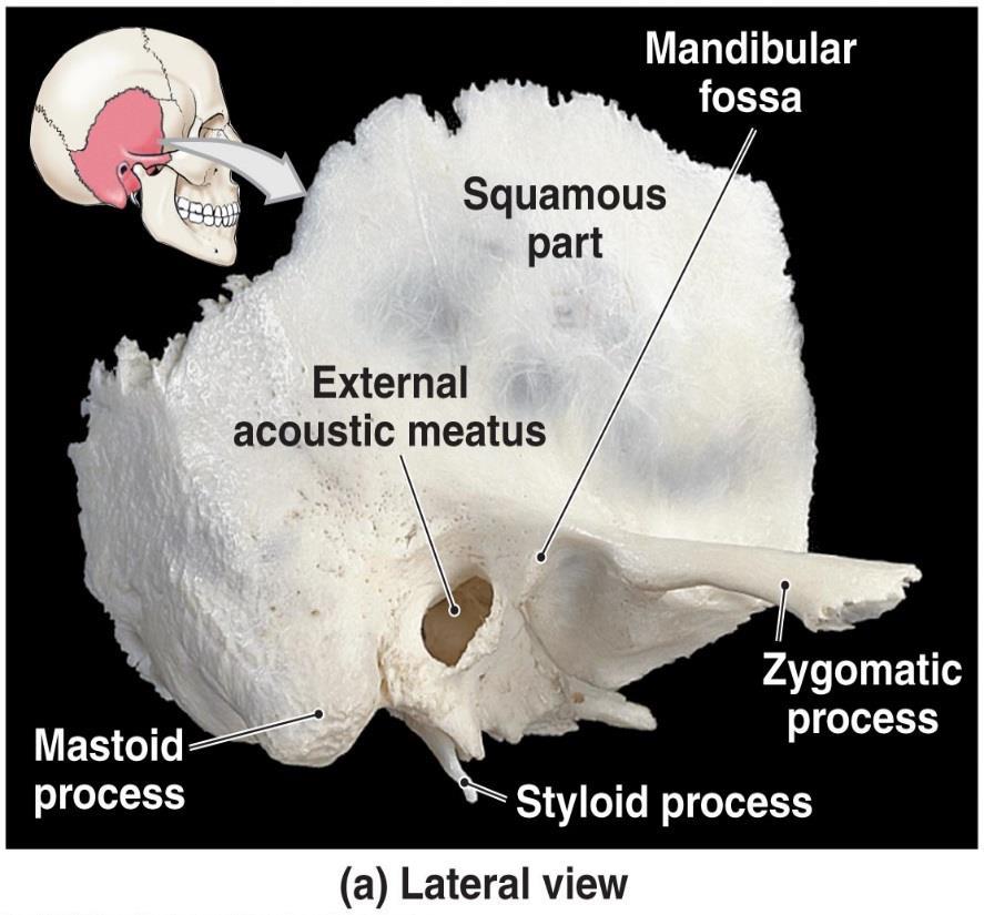 Marks of the Temporal Bones Styloid (stylo = stake) process