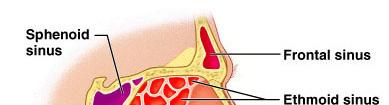 The Paranasal Sinuses Inflammation of the