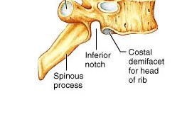 The Thoracic Vertebrae The spinous process of the typical