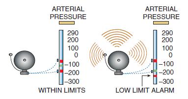 Arterial / Venous Pressure Monitors Arterial pressure monitor is leak free with adjustable high/low
