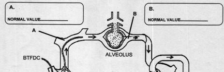 Arterial Line (A-line) Inserted into an artery Central Venous Catheter (CVP) Inserted into a