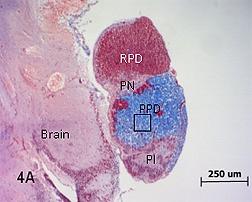 basophils (blue cytoplasm), and a few acidophil (red