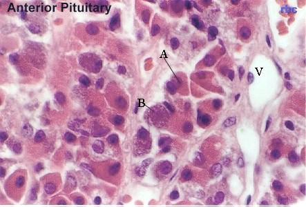 The above photos show higher magnifications of the pars distalis. You should be able to distinguish acidophils and basophils in this and your slide.