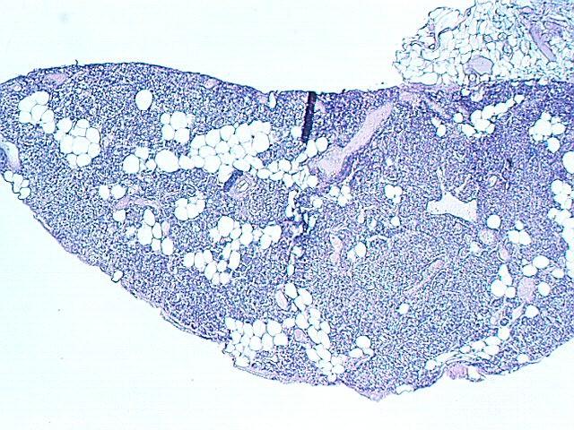 The parathyroid gland is distinguished by scattered clumps of adipose cells (seen in the above photograph) lying among the parenchymal cells.