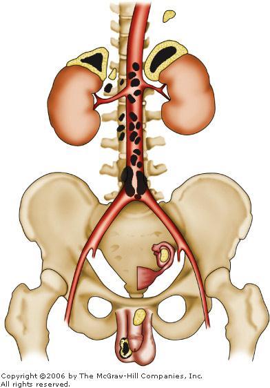 Adrenal (Suprarenal) Glands They are about 4 6 cm long, 1 2 cm wide, and 4 6 mm thick, together they weigh about 8 g.