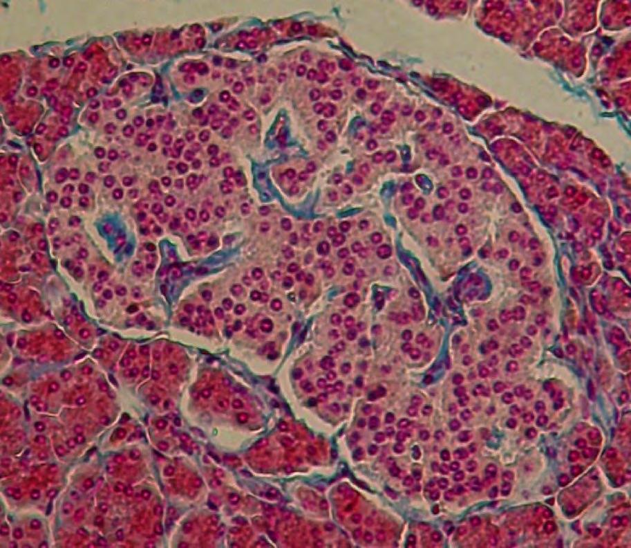 Pancreas islet