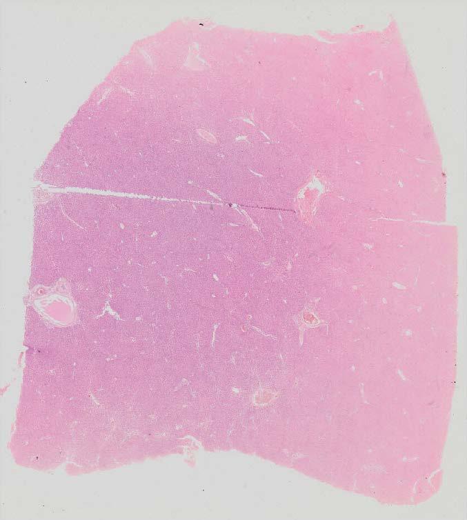 Overview Liver parenchyma - hepatocytes (cells) - sinusoids