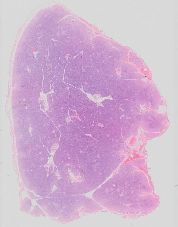 Overview Connective tissue capsule Parenchyma of exocrine pancreas (dark staining) Blood vessel Interlobular duct