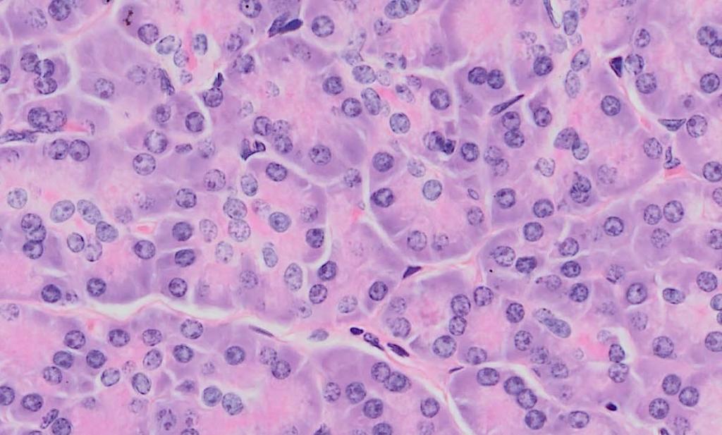 Exocrine Cell Types Acinus Pancreatic acinar cell Basophilic basal cytoplasm of pancreatic acinar
