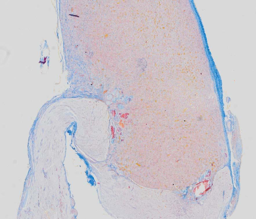 Overview Pars tuberalis Pars intermedia Connective