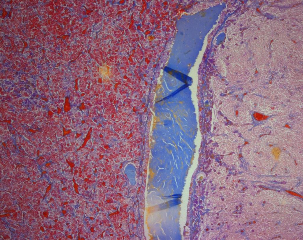 Functional Areas Pars distalis - red and blue stained