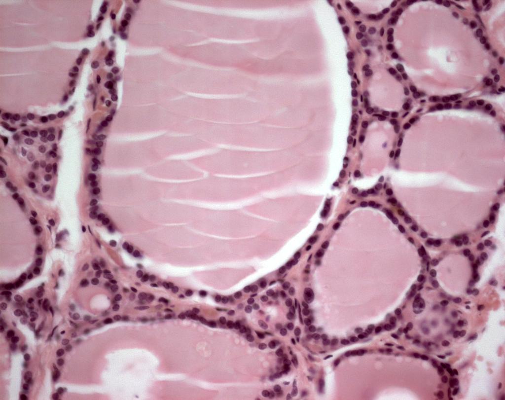 Parafollicular Cells Parafollicular cells - found within the