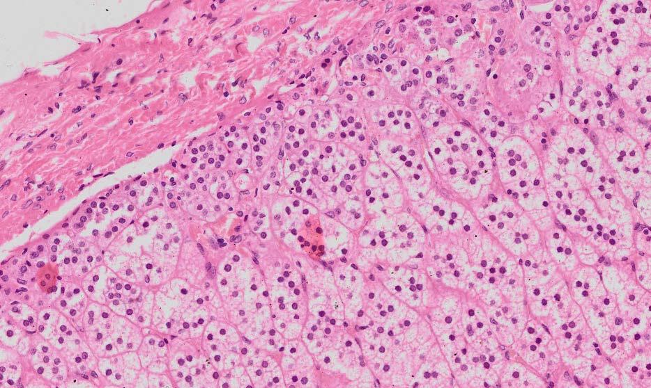 Zona Glomerulosa Connective tissue capsule Zona