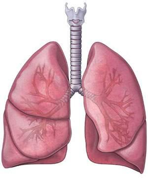 20% of screened population will have multiple lung tumors
