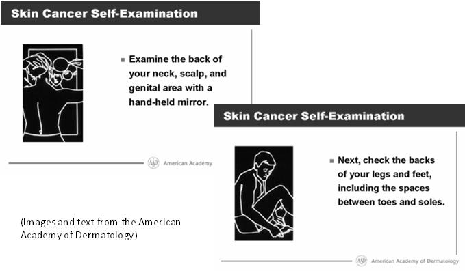 Encourage self skin exams (Images and text from the American Academy of Dermatology) Ultraviolet Radiation Sunlight consists of two types of harmful ultraviolet (UV) rays that