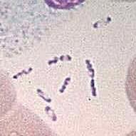 Plague (Yersinia pestis) Wayson stain of Yersinia pestis.