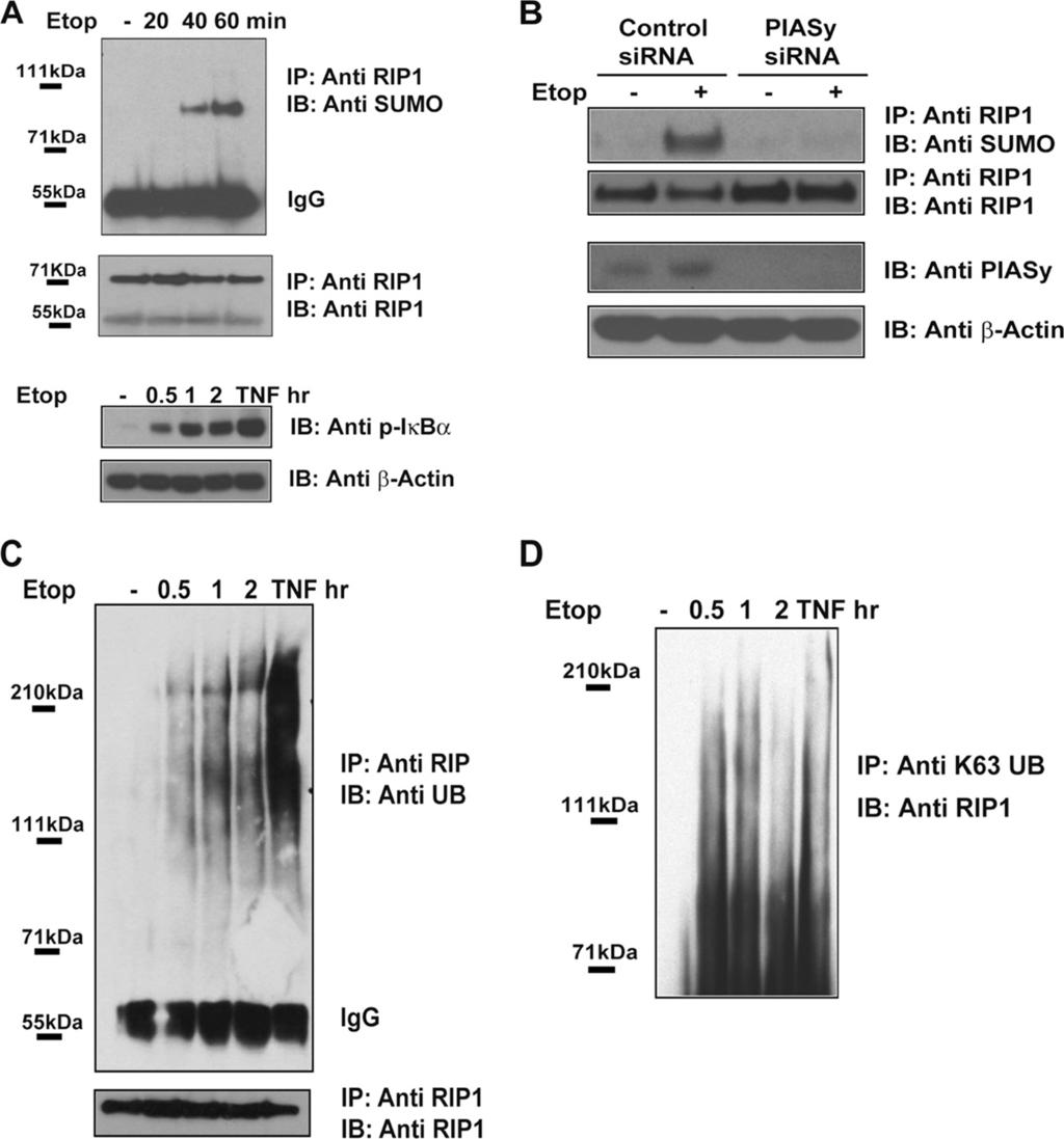 VOL. 31, 2011 RIP1 AND TAK1 PROTECT CELLS FROM DNA DAMAGE 2777 FIG. 2. DNA damage stimulates the SUMO and ubiquitin modification of RIP1. (A) DNA damage stimulates the SUMO-1 modification of RIP1.