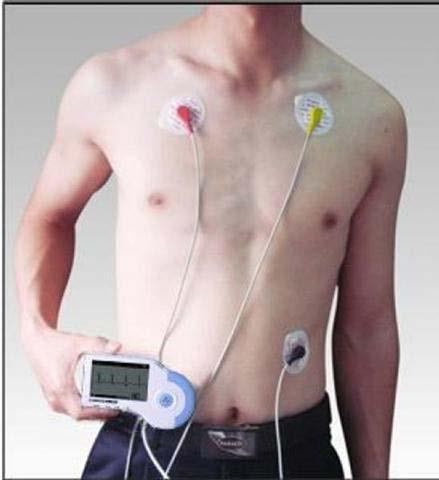 Anaesthetic Monitoring ECG Correct lead placement RED Right arm YELLOW Left arm GREEN Left