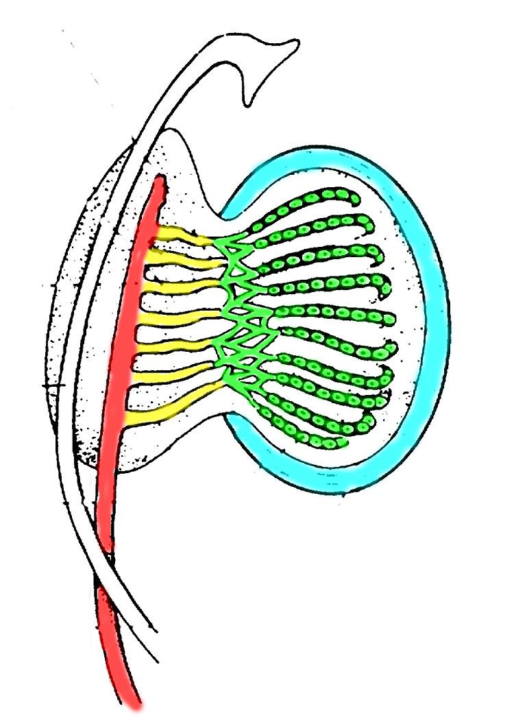 Mesonephric (Wolffian Duct)" Testicular