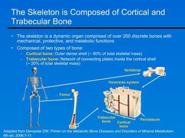 Overview Osteoporosis and