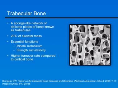 Osteoporosis Osteomalacia