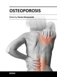 Osteoporosis Edited by PhD.