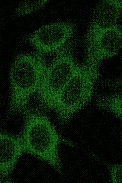 antibody (ANA) Sometimes the pattern will reveal the type of ANA