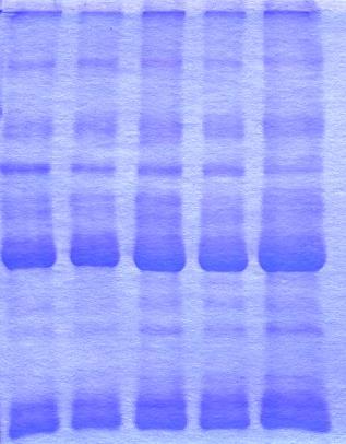 cells to make a cellular soup Add denaturing agent and separate proteins according to size using electrophoresis