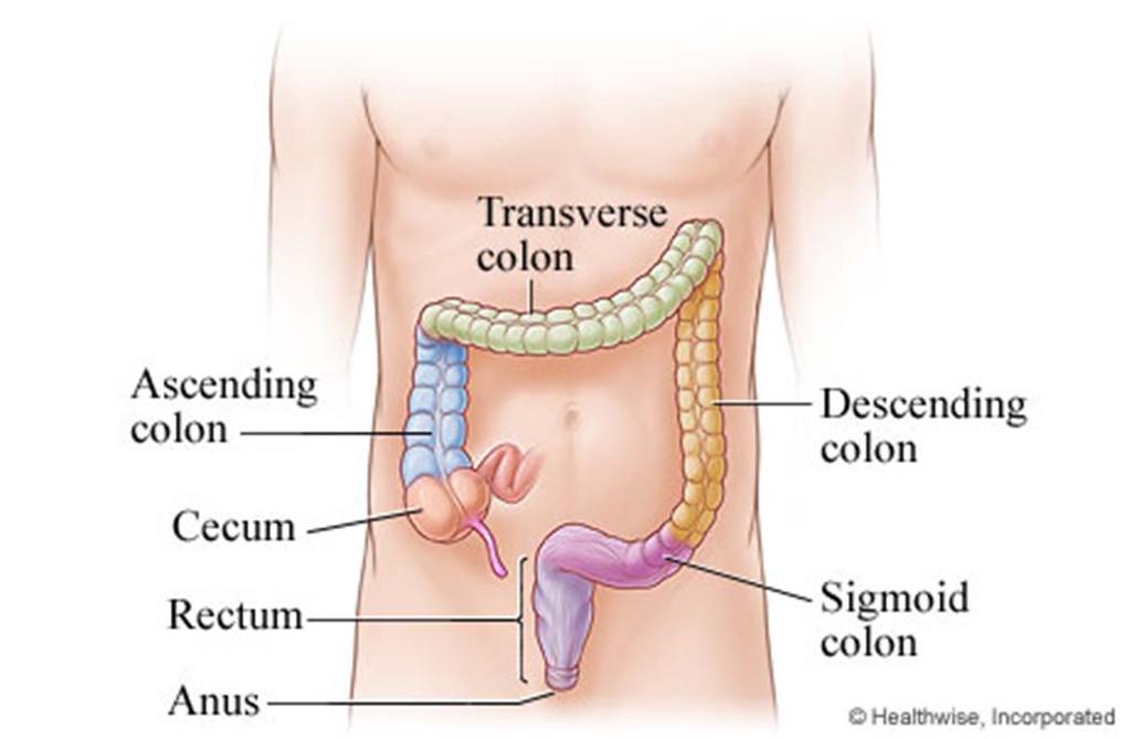 Colectomy and