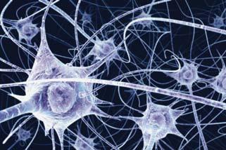 Stroke Normal Brain: 22 billion neurons, 150 trillion