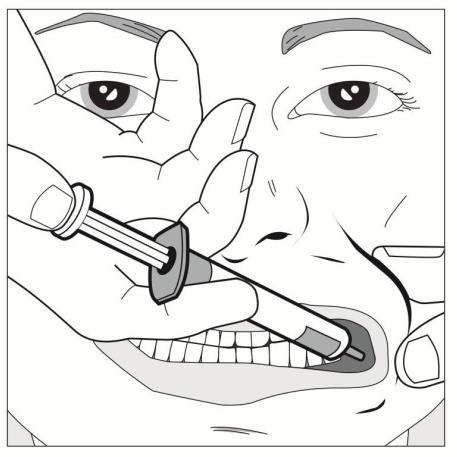 The full amount of solution should be inserted slowly into the space between the gum and the cheek (buccal cavity).