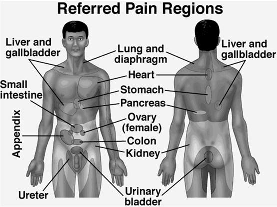 Clinicians should not chase pain Rule-out proximal sources of pain Determine the structure(s) that are responsible for
