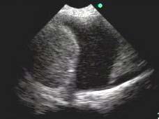Assessment of the pleural space for effusion Ultrasonographic diagnosis The sonographic