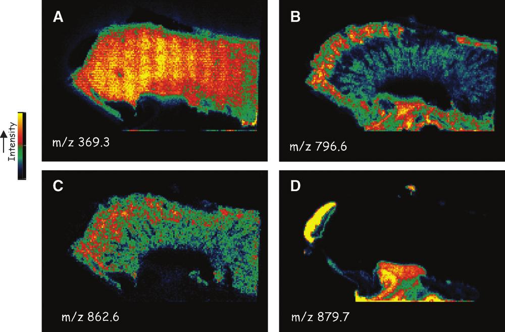 Fig. 3. MALDI-MSI ion images from a section of mouse kidney. Data acquisition and image processing are described in Ref. 9. A: m/z 369.3, [M1H H 2 O] 1, cholesterol. B: m/z 796.6 [16:0a/18:2-PC1K] 1.