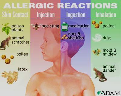 ALLERGY May affect up to 20% of people Allergic reaction can be provoked by: Ingesting nuts, shellfish, eggs