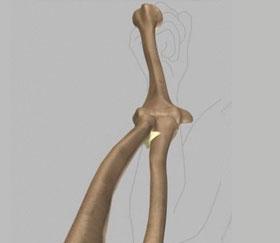 20) Annular ligament This ligament forms a ring around the head of the radius bone, holding it tight