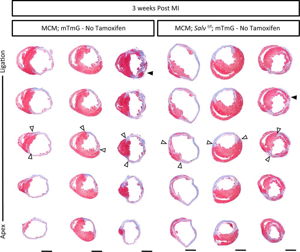 RESEARCH Letter Extended Data Figure 3 Histological analysis at 3 weeks after myocardial infarction.