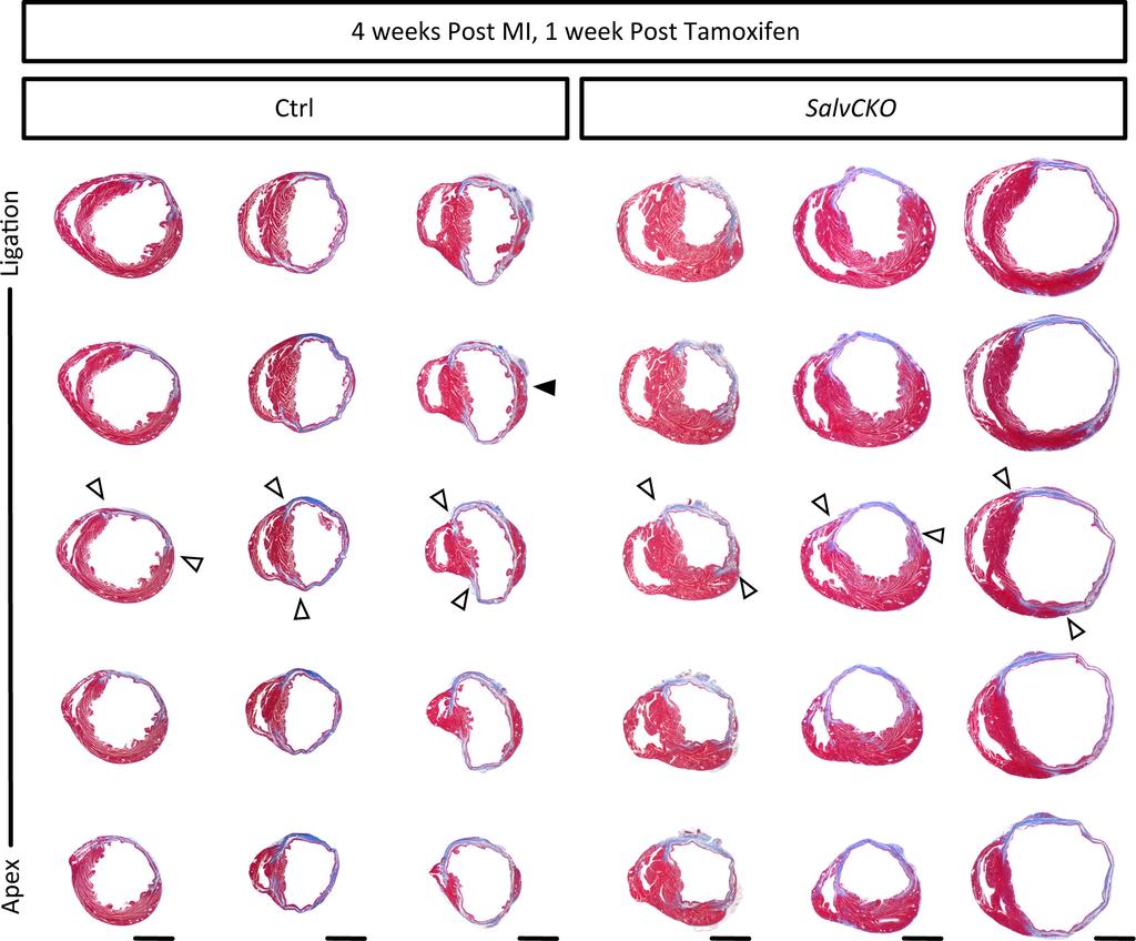 Letter RESEARCH Extended Data Figure 4 Histological analysis at 4 weeks after myocardial infarction.