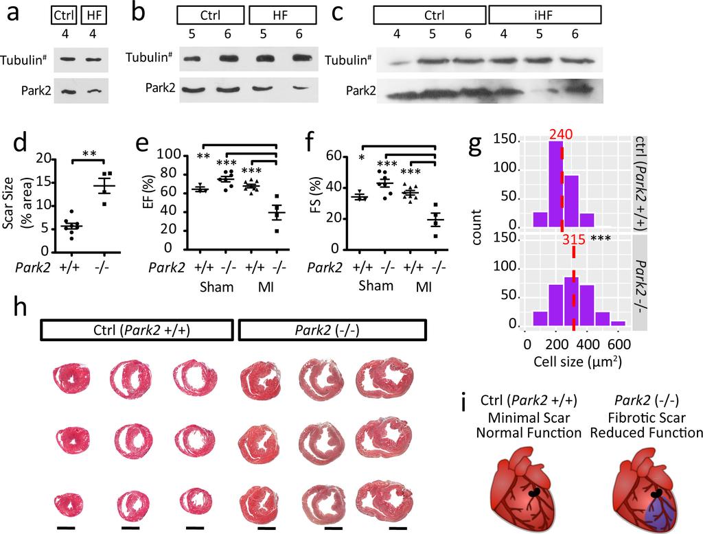 RESEARCH Letter Extended Data Figure 9 Requirement of Park2 in the regenerating mouse heart. a c, Human heart western blots; quantification presented in Fig.