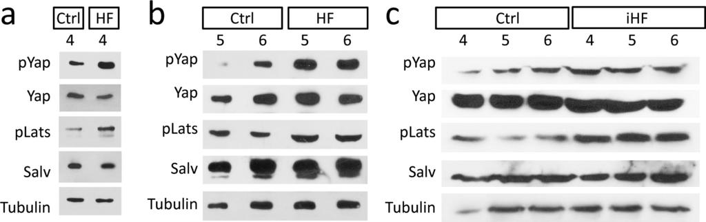 RESEARCH Letter Extended Data Figure 1 Activated Hippo signalling in human heart failure. a c, Western blots of human heart samples. Ctrl: non-failing non-transplantable, n = 6 (a c).