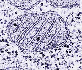 site of protein synthesis assembled in nucleoli 21 22 Mitochondria Organelles With DNA bounded by exterior and interior