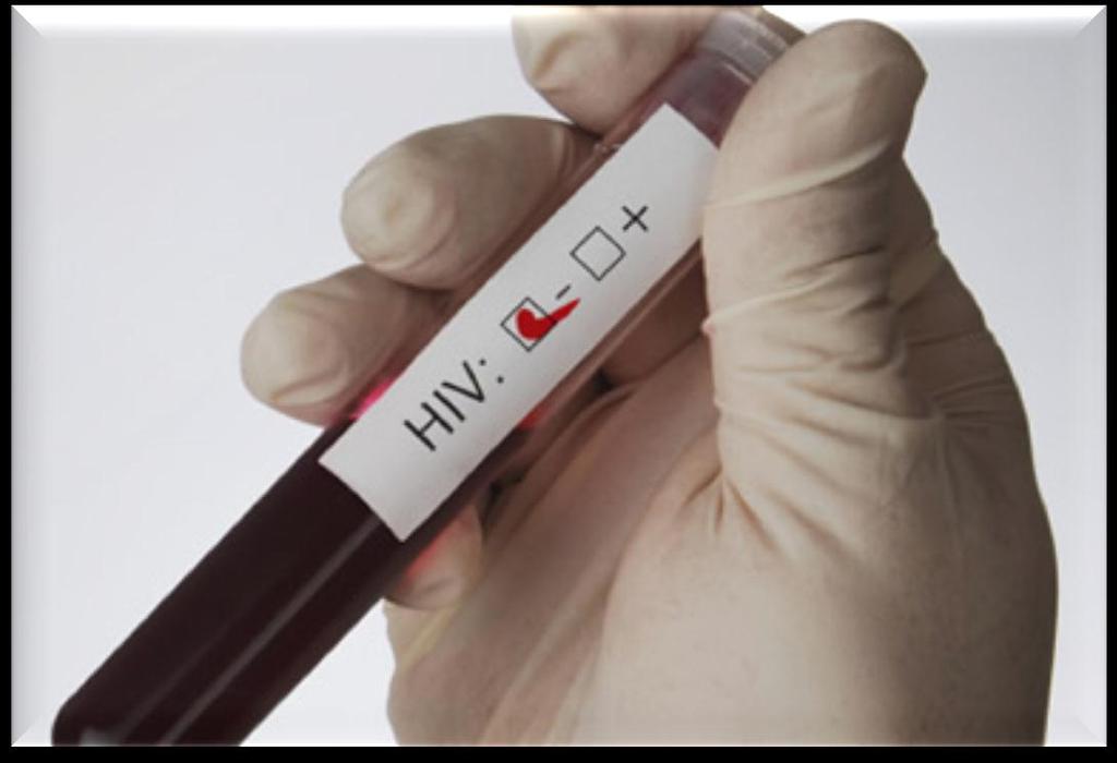 HIV TESTING