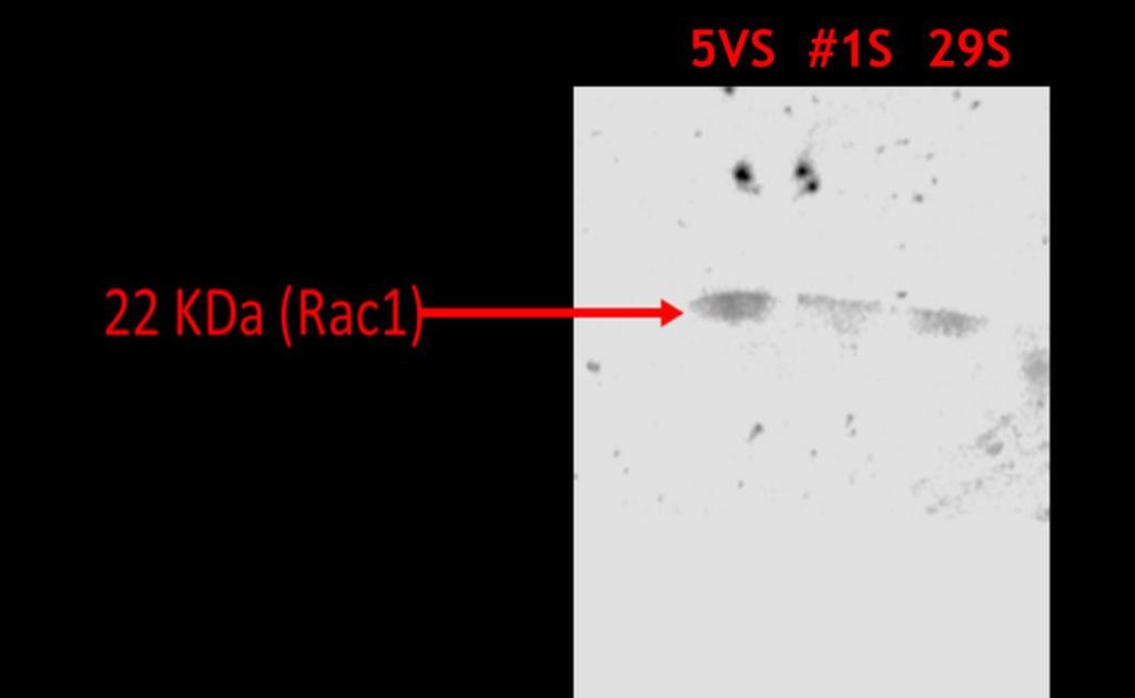 Correlation of Rac1 Activation With CD82 Expression A Rac1 assay was used to isolate the activated form of the Rac1 protein from cellular suspesions.