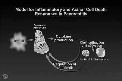 pain Amylase and/or lipase > 3 times upper limit of normal CT scan showing characteristic findings of AP No Disclosures Acute Pancreatitis:
