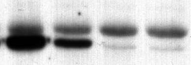 3 30 μm) prevented Akt phosphorylation. MDA-MB-231 cells were treated with Compound 15e (0.3 30 μm)) for 1 hr.