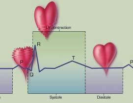FIGURE 1. An echocardiographic trace of the atrial and ventricular phases of cardiac contraction and relaxation. FIGURE 2.