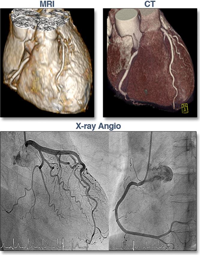 JACC: CARDIOVASCULAR IMAGING, VOL. 4, NO. 1, 2011 55 could not be evaluated by CT; 60 further segments were stented, and 270 segments had a diameter 1.5 mm (Fig. 3).