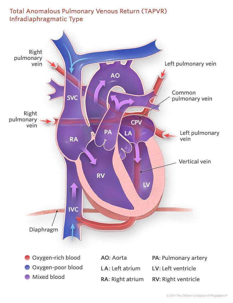 pulmonary