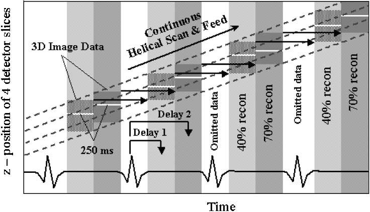 226 IEEE TRANSACTIONS ON NUCLEAR SCIENCE, VOL. 51, NO. 1, FEBRUARY 2004 heart rate and its variation on the image quality has not had a systematic study.
